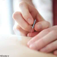 آموزش طب سوزنی مقدماتی تا پیشرفته
