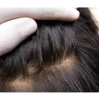 پاکسازی شپش سر تضمینی