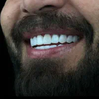 مجموعه دندان پزشکی/دندانسازی/زیبایی/اقساطی/چک