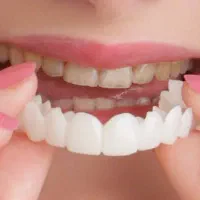 لمینت دندان