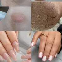کاشت ناخن و کفسابی تخصصی پا/کیفیت بالا.قیمت مناسب
