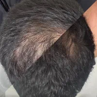 موهای پرپشت با متد اروپایی و گیاهی