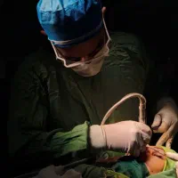 عمل بینی اقساطی در شیراز ، اقساط تا ۱۲ ماه