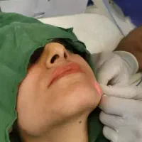 اندولیفت ، لیفت و جوانسازی صورت وگردن توسط پزشک