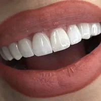 خدمات دندان پزشکی/شرایط اقساطی/کلینیک