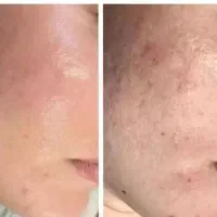 کرم بیوممتیک چند کاره