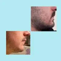 محوصلات گیاهی و ارگانیک