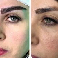 کاشت مو«۲۳»کاشت ابرو«۱۴» شیرازی