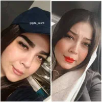 کاشت مو و ابرو میکرو کاشت (رایگان)