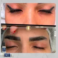 مدل برای پاک کردن تتو ابرو، خط چشم و آنزیم تراپی