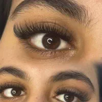 کاشت مژه هیدن فقط300