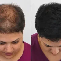 موهات جنگل آمازون میشه