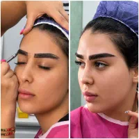 کاشت ابرو طبیعی /قبل از کاشت طرحت رو ببین