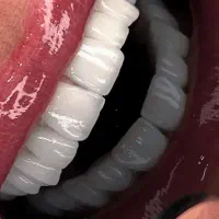 پایین ترین قیمت دندانپزشکی در ایران