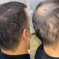 موهاتو اسبی کن