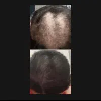 رویش سریع|آرایشی، بهداشتی، درمانی|اسفراین, |دیوار
