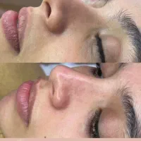 پاکسازی و درما سالن و خال زیبایی پری رخ