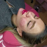 ژل وبوتاکس با قیمت استثنایی