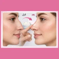 لیفت بینی بدون عمل جراحی