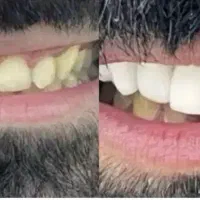 کلیه خدمات دندان پزشکی اقساطی