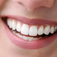 عصب کشی دندان های جلویی