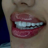 کامپوزیت لیرینگ(لبه شیشه ای) با قیمت پایین