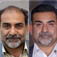 کاشت مو/ابرو/ریش/اقساطی/بدون جراحی