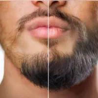 دیگه کاشت ریش نکن