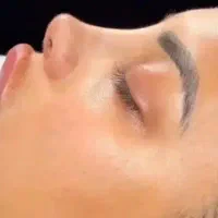 عمل بینی در بیمارستان۴۰ تومن و کلینیک ۳۰ تومن