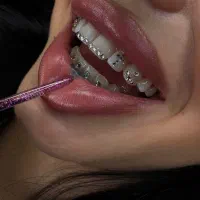 پیرسینگ،نگین دندون،میکرودرمال،بوتاکس