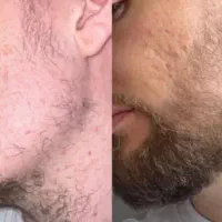 کمکت میکنم از افسردگی در بیای