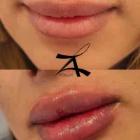 جشنواره تخفیف لیزر،لاغری،زیبایی،طب سنتی