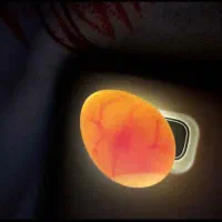 تخم نطفه دار عروس البینو