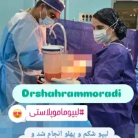 پزشک متخصص زیبایی صورت و اندام( پال) پلک چربی فیلر