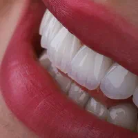 دندانپزشکی ارتودنسی ایمپلنت دیجیتال لمینت درمانی