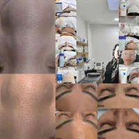 پاکسازی پوست یک نیاز اساسی برای شادابی و جوانی