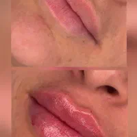 کلینیک تخصصی ژل فیلر بوتاکس مزوتراپی (پزشک)