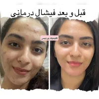 پاکسازی و فیشال تخصصی درمانی