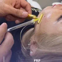 معجزه جوانسازی (پی آر پی)