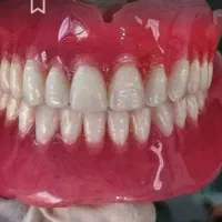 احتیاجیه دست دندون  مصنوعی