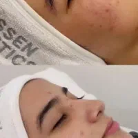 فیشال