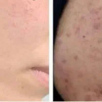 ضدلک برای برگردوندن اعتمادبنفس شما