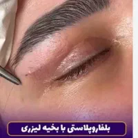 بلفاروپلاستی لیزری متخصص چشم(ایرانا)
