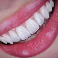لابراتوار دندانسازی