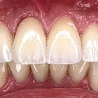 دستیار دندانپزشک