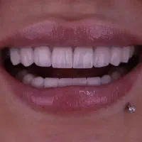 دندانپزشکی در محیطی آرام و بدون درد