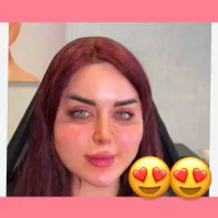 ژل لب/بوتاکس/فول فیس/تخفیف ویژه/کلینیک معتبر