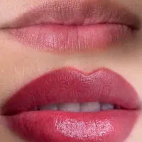 کاشت مژه 500