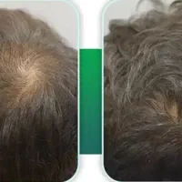 اگه ریش داری و مو نداری یعنی ریشه نداری
