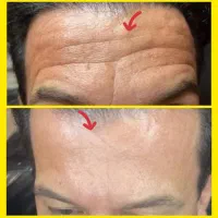 بیوممتیک ۱۲ کاره جوانساز فوری